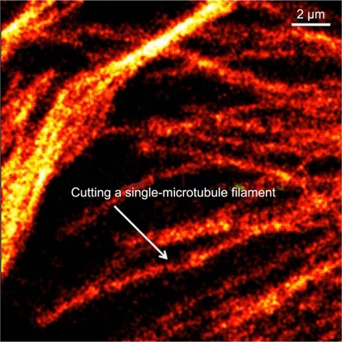 Figure 10 Live monitoring with stimulated emission-depletion atomic force microscopy of a microtubule-related surgery at nanoscale level.Notes: The arrow indicates that a single microtubule could be cut in a precise and controlled place, thus emphasizing the benefits of combining the two techniques. Reprinted from Chacko JV, Harke B, Canale C, Diaspro A. Cellular level nanomanipulation using atomic force microscope aided with superresolution imaging. J Biomed Opt. 2014;19:105003. Copyright 2014.Citation78