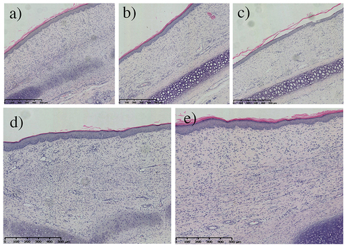 Figure 2 HE staining results of scar tissue from five groups at 28 days post-surgery.