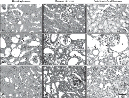 Figure 2. Photomicrographs of kidney sections stained with hematoxylin-eosin (A, D, G), Masson's trichrome (B, E, H), and periodic acid-Schiff-hemalen (C, F, I). (A, B, C) Control rats. (D, E, F) Cisplatin-treated rats, arrowhead; tubular epithelial cell exhibited enlarged nuclei with basophilic cytoplasm, arrow; thickening of the basement membrane in the renal tubules and Bowman's capsule, asterisk; enlarged periglomerular spaces. (G, H, I) Cisplatin + vitamin C-treated rats (Scale bar: 50 μm).