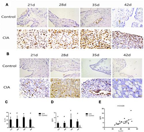 Figure 4 Expression of IL-21r and IgG4 in experimental rats. (A) IL-21r was not significantly upregulated in the ankle joints of control group rats at various stages. Positive IL-21r cells were observed in the CIA group between days 21 and 42, and their expression was mainly concentrated on the thickened synovial membrane. Various inflammatory cells were mainly found in the 42 day group (IL-21r x400). (B) IgG4 expression in rats; there was no obvious IgG4 expression at all stages of the ankle joint in the control group. IgG4-positive cells were observed from days 21 to 42 in the CIA group, which were primarily expressed in the thickened synovial membrane (IgG4 x400); bars = 50 μm. (C) Expression of IL-21r in the ankle joints of the CIA group significantly exceeded that in the negative group in four stages (P < 0.05). (D) IgG4 expression of each group; the outcome of IgG4 in the CIA group was significantly higher than that in the negative group at the four stages (P < 0.05) (Mann–Whitney U-test). (E) IgG4 and IL-21r inflammatory cells showed a positive relationship in the model group (r = 0.633, P < 0.05) (Spearman correlation analysis). #P < 0.05.