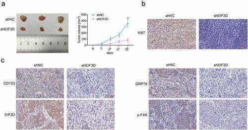 Figure 6. Downregulation of EIF3D suppressed tumor growth of cervix cancer cells via GRP78-FAK axis. (a). Xenograft assay showed the tumor growth and weight difference between the indicated groups. (b). IHC assays showed the expression of Ki67 in tumor tissues from the indicated groups. (c). IHC assays showed the expression of CD133, EIF3D, GRP78, and phosphorylated FAK (p-FAK) in tumor tissues from the indicated groups. Data are shown as mean ± SEM, ** p < 0.01.