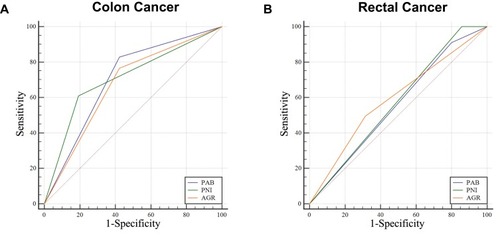 Figure 4 Receiver operating characteristic (ROC) analysis of prealbumin (PAB), prognostic nutritional index (PNI), and albumin and globulin ratio (AGR) in colon and rectal cancer. (A) Colon cancer; (B) Rectal cancer.