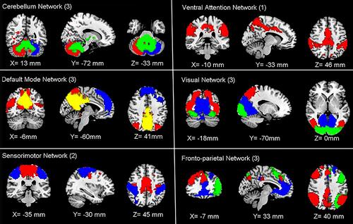 Figure 4 Functional associated resting-state networks (RSNs). The spatial maps of 15 independent components were identified and classified as RSNs for function network connectivity analysis.