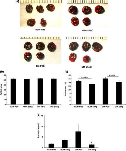 Figure 2. Impact of myocardial infarction (MI) in SANGUINATE™-treated diabetic and normal mice prior to LAD occlusion and during 48 h of reperfusion. Hearts retrieved after LAD ligation followed by 48 h of reperfusion and subjected to TTC staining (a) for the analysis of total area at risk (b) and infarcted area (c) in the following groups of mice: normal PBS-treated (NDM-PBS), SANGUINATE™-treated NDM (NDM-Sang), diabetic PBS (DM-PBS), and SANGUINATE™-treated DM (DM-Sang). (d) Troponin-C release in plasma, marker of ischemic injury, was also determined in all the groups of mice during the 48 h of reperfusion. NDM-Sang and DM-Sang mice received i.p. injections of SANGUINATE™ prior to LAD ligation and during 48 h of reperfusion. NDM-PBS and DM-PBS mice received i.p. injections of an equivalent volume of PBS vehicle prior to LAD ligation and during 48 h of reperfusion. (n = 12 in each group).