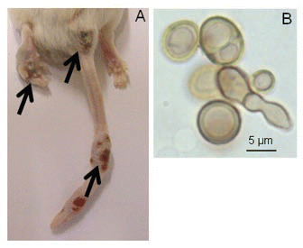 Figure 2 Metastasis of sclerotic-like cells in animals stimulated at two sites. (A) Mouse infected in the footpad with F. pedrosoi cells; the animal received a simultaneous immunization i.p. with heat-killed fungal cells. (B) Common morphology of sclerotic-like cells that migrated to other sites, 1000x.