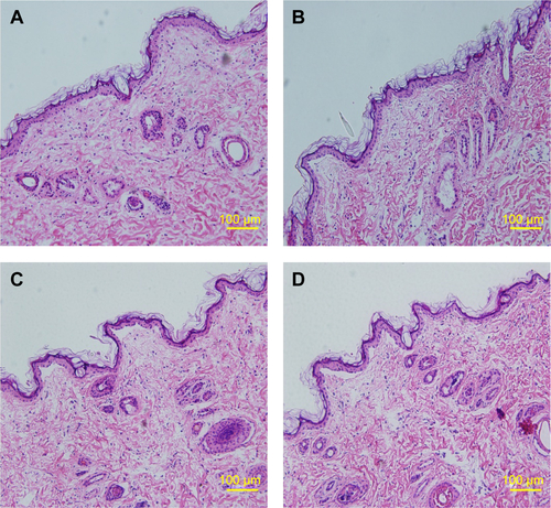 Figure S3 Histopathological analyses of skin.Notes: (A) Control; (B) stationary magnetic field; (C) alternating magnetic field; and (D) stationary/alternating magnetic field.
