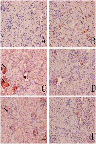 Figure 5. C3 deposition in mouse renal tissue. (A) Control. (B) Solvent control. (C) TCE+. (D) TCE−. (E) PDTC+. (F) PDTC−. Black arrows indicate deposition of C3. Magnification = 200X.