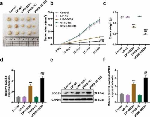 Figure 6. UTMD-mediated SOCS3 showed higher inhibition on tumor growth of BC mice than liposome-mediated SOCS3. (a-c) The tumor xenograft model was constructed to detect the effects of different transfection methods of SOCS3 on the volume and weight of tumors in nude mice. (d-f) The expression of SOCS3 in the tumor tissues of mice was calculated by RT-qPCR and Western blot. Each experiment was repeated three times independently. GAPDH was set as the control. ***P < 0.001 vs. LIP-NC; ^^^P < 0.001 vs. UTMD-NC; ###P < 0.001 vs. LIP-SOCS3.