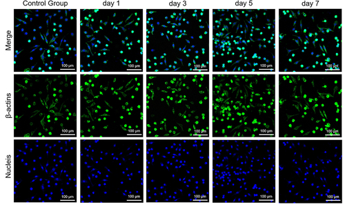 Figure 15 Laser scanning confocal microscopic images of L929 cells incubated with eluted group D specimens at different times (1, 3, 5, and 7 days) for 24 h. All images were taken under identical instrumental conditions and presented using the same intensity scale.