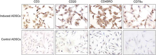 FIGURE 3. hADSCs differentiation into lymphocyte-like cells in vitro.Immunocytochemistry results showed that passage 6 hADSCs cultured in the lymphocytic inducement medium for 14 days were strongly positive for lymphocytic markers including CD3, CD20, CD45RO, and CD79a compared with the control groups. Bar = 100 µm.