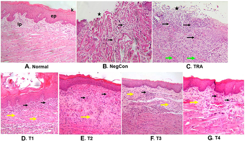 Figure 4 The differentiation in histopathology features between groups. A black asterisk indicates an open ulcer, the black arrow shows the distribution of inflammatory cells, while the green arrow shows the dilated vessels, and yellow arrows shows fibrosis (magnification 100X).