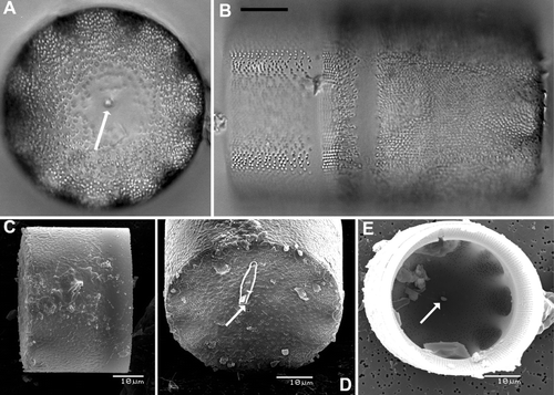 Figure 10  Light (A,B) and scanning electron (C–E) micrographs of Cavernosa kapitiana from the type population on Kapiti Island, New Zealand. A, LM valve view with the presence of a rimoportula (arrow) and the typical caverns. B, LM girdle view showing the mantle and part of the girdle. C, SEM picture of the mantle. Note the comparably small spines. D, SEM valve face view of a concave valve with the opening of the rimoportula (arrow) and the typically ornamented surface structure. E, SEM internal view with the position of the rimoportula (arrow) and the caverns. Scale bars, 10 μm.