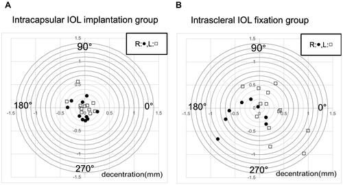 Figure 3 Distribution of intraocular lens (IOL) decentration. IOL decentration distribution in the intracapsular IOL implantation group (A) and intrascleral IOL fixation group (B) are shown. Black dots indicate right eyes, while white squares indicate left eyes.