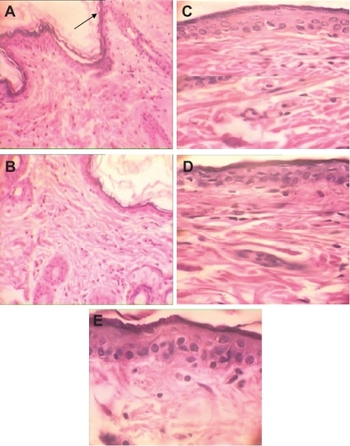 Figure 4 H&E stained skin sections in subchronic toxicity (× 40). A) Normal skin in control group; B) AgNO3 group with reduced thickness of dermis and epidermis, increased Langerhans cells, inflammation, decreased thickness of papillary zone layer, and increased collagen levels of dermis layer; C) Skin abnormalities in low-dose nanosilver group; D) Skin abnormalities in high-dose nanosilver group; E) Highest level of dermal toxicity (see text for further details).