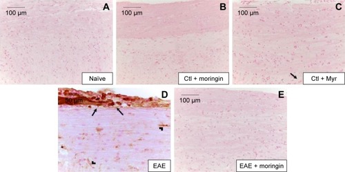 Figure 8 Moringin modulates IL-6 expression in EAE.