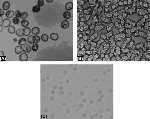 Figure 1. (A) Photomicrograph of normal erythrocytes. (B) Photomicrograph of erythrocytes ghosts. (C) Photomicrograph of SEM of drug loaded nanoerythrosomes.