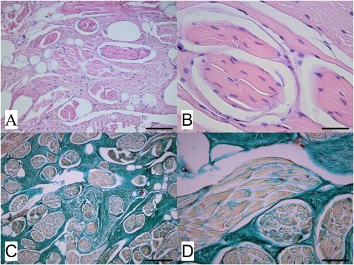 Figure 2. Photomicrographs of a dermal mass removed from the neck of a red deer (Cervus elaphus) showing A) a representative area of the mass located within the deep dermis and comprising well differentiated muscle bundles surrounded and often widely separated by an extensive collagen stroma (H&E; bar = 75 µm) and B) detail of several muscle bundles within the mass and, in the upper right of the image, an area of collagen stroma (H&E; bar = 35 µm). Slides shown in C) (low magnification; bar = 75 µm) and D (high magnification; bar = 35 µm) are stained with Masson’s trichrome stain, and show the different components of the mass, with muscle bundles staining pale orange-red while the surrounding collagen stroma stains blue-green.