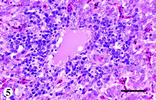 Figure 5. Liver from a 47-day-old broiler chicken infected with M. synoviae, showing prominent and vacuolated endothelial cells and infiltration by lymphocytes, a few plasma cells and macrophages in and around a blood vessel. Haematoxylin and eosin, bar=75 μm.