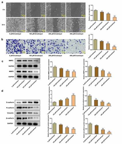 Figure 2. Eriodictyol treatment suppresses migration, invasion, and EMT of CRC cells. HCT116 cells were treated with 0, 100, 200, 400 μM eriodictyol for 48 h. (a) Wound healing assay was employed to detect CRC cell migration. (b) Transwell invasion assay was employed to detect CRC cell invasion. (c) Western blot analysis was employed to detect the levels of MMP2 and MMP9 in CRC cells. (d) Western blot analysis was employed to detect the levels of E-cadherin, N-cadherin, Vimentin, and β-cadherin in CRC cells. ** p < 0.01, *** p < 0.001 versus 0 μM Eriodictyol.