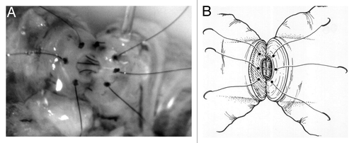 Figure 1. (A) Schematic representing re-approximation of vasal mucosa as part of a 4-layer closure using 10–0 nylon sutures with the microdot technique. (B) Intraoperative vasovasostomy repair – note the microdots spaced approximately 20 µm in diameter.