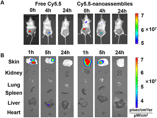 Figure 6 (A) In vivo imaging of Cy5.5-nanoassemblies in IMQ-induced psoriasis-like mice after the application of Cy5.5-nanoassemblies loaded microneedles at 0h, 4h and 24h, respectively. (B) Ex vivo images of the skin and main organs at 1h, 5h and 24h, respectively.