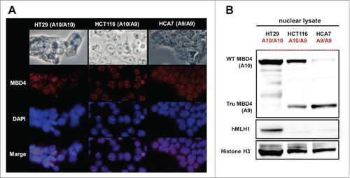 Figure 1. Both normal MBD4 protein and TruMBD4 localize to the nucleus in colorectal cancer cells. (A) Upper row: light microscopy of human colon cancer cell lines HT29 (MMR-proficient, MBD4A10/A10), HCT116 (hMLH1−/-, MBD4A10/A9) and HCA7 (hMLH1−/-, MBD4A9/A9); Second row: Indirect immunofluorescence microscopy utilizing anti-MBD4 antibody with Alexa Fluor 594-conjugated secondary antibody (staining red); Third row: DAPI staining of nuclei; Fourth row: merge of second and third row images. (B) Western blot of colorectal cancer cell nuclear lysates for MBD4 and TruMBD4 expression. Signals were detected by an LAS-4000 luminescent image analyzer (GE Healthcare Bio-Sciences) utilizing a chemiluminescent solution.