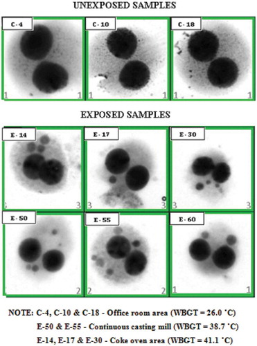 Figure 5. Micro nuclei assay images of different slide sections for exposed and unexposed workers using automated cyto-genetic imaging.