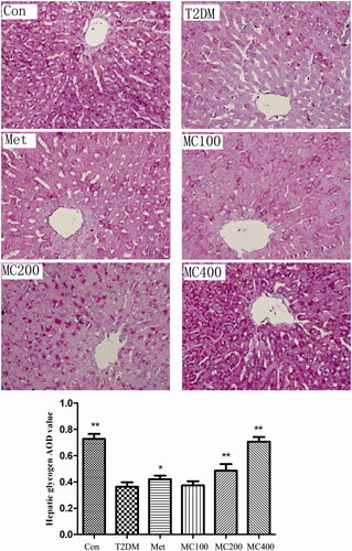 Figure 3. The change of liver glycogen. The result of liver glycogen PAS dyeing (×400), Con: control; T2DM: Type 2 diabetes mellitus; Met: Metformin; MC100: MCE 100 mg; MC200: MCE 200 mg; MC400: MCE 400 mg. *p < 0.05 and **p < 0.01 the T2DM group versus control and treated groups.