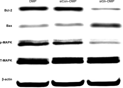 Figure 5 Anti-glioma molecular mechanism of DMP–Gli1si.Notes: When U87 cells were transfected with DMP, DMP–Consi, or DMP–Gli1si, the Bcl-2, Bax, p-MAPK, and T-MAPK expressions were tested by Western blotting. Moreover, results showed that levels of Bcl-2 and p-MAPK were downregulated and Bax was upregulated after treatment with DMP–Gli1si.Abbreviation: DMP, 1,2-dioleoyl-3-trimethylammonium-propane and methoxy poly(ethylene glycol)-poly(lactide) copolymer.