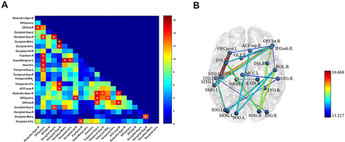 Figure 1 Significant differences in FCs among the aPD, naPD, and HC groups. (A) T-value matrix of functional connectivity between the three groups. (B) Visualization of differential functional connectivity.