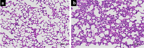 Figure 1. Histologic changes in mouse lung tissue. The histologic changes in control mice (a) and SII mice (b) were examined using HE-staining.