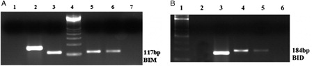 Figure 3. H3K27me3 histone modification on promoter region of BIM and BID genes in K562/IMA-3 cell lines was determined by ChIP-PCR. (A) (1) negative control, (2) positive control, (3) 2% input DNA, (4) M:50 bp, (5–6) K562/IMA-3 cell lines, (7) no DNA. (B) (1) M:50 bp, (2) negative control, (3) positive control, (4) 2% input DNA, (5) K562/IMA-3 cell line, (6) no DNA.
