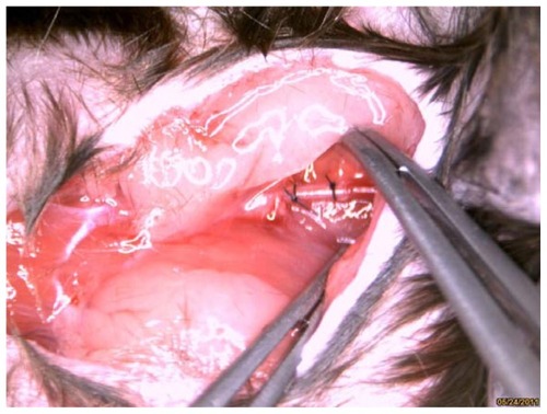 Figure 1 Carotid collar model is clearly visible in bright field anatomic image.