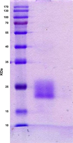 Figure 2 SDS–PAGE of HCV1b-E2 band protein with a molecular weight of 20 kDa.Abbreviation: SDS–PAGE, sodium dodecyl sulfate–polyacrylamide gel electrophoresis.