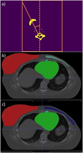 Figure 2. a: Head angle determination: performing a linear regression of the voxels (with bone HU window) of the last CT slices inside a bounding box that includes the head, b: Volumes segmented by the lumpectomy model and c: Volumes segmented by the mastectomy model.