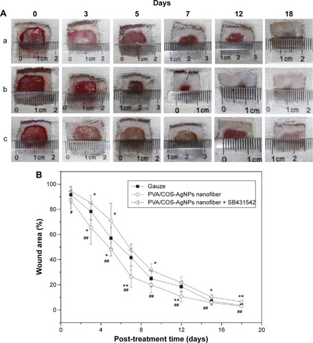 Figure 1 PVA/COS-AgNPs nanofiber treatment decreases wound area of wounded rat skin and achieves better cosmesis.Notes: (A) Full-thickness incisional wounds of group (a) gauze, (b) PVA/COS-AgNPs nanofiber, (c) PVA/COS-AgNPs nanofiber plus SB431542 at 0, 3, 5, 7, 12, and 18 days after surgery. (B) The change in wound closure size displayed as a percentage of wound area at different healing times. Each wound area measurement was compared with the wound area on day 0. Values are mean ± standard deviation. *P<0.05 and **P<0.01 vs gauze group, #P<0.05 and ##P<0.01 vs PVA/COS-AgNPs nanofiber plus SB431542 group.Abbreviations: PVA, poly(vinyl alcohol); COS, chitosan oligosaccharide; AgNPs, silver nanoparticles.