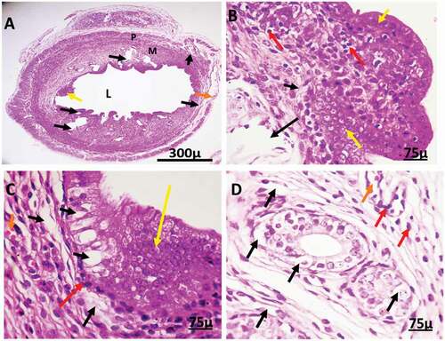 Figure 8. Photomicrographs of uterine tissue of female rats treated with (4 mg/kg AgNps).H&E stain. L = Lumen.