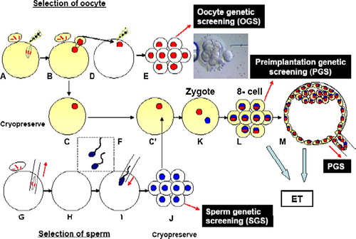 Figure 7.  Selection of ‘good’ gametes and embryos to guarantee the birth of healthy offspring by assisted fertilization. (A–E) Selection and preservation of oocytes. (F–J) Selection and preservation of spermatozoa. (K–M) Construction of zygotes and production of transferable embryos. Abbreviations: OGS: oocyte genetic screening; SGS: sperm genetic screening; ET: embryo transfer; PGS: preimplantation embryo genetic screening.