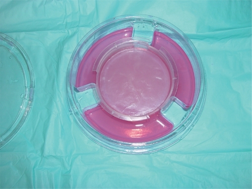 Figure 1 Apligraf ® as it is received from the manufacturer. Note that the epidermal side is dull-appearing and facing upwards.