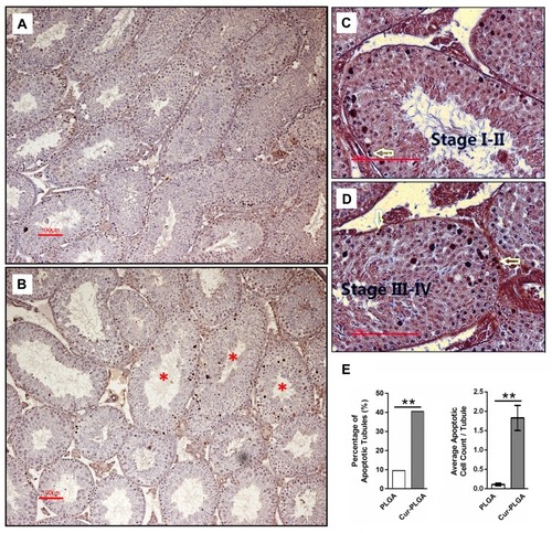 Figure 6 Induced apoptosis of spermatogenic cells by Cur-PLGA-NPs treatment. (A) Control group treated by 50 μM PLGA-NPs. (B–D) Experimental group treated by 50 μM Cur-PLGA-NPs. Asterisk, the representative affected tubules; arrow, spermatogonia. Bar = 100 μm. (E). Quantitative measurement of apoptotic events. **P< 0.01.