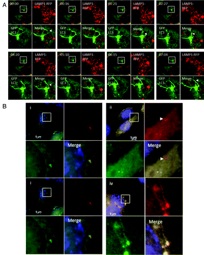 Figure 7. Interaction of tubulovesicular autophagosomes with lysosomes. (A) LAMP1-RFP was expressed transiently in CHO-cells expressing GFP-LC3. Cells were incubated with lipoplex and images captured from live cells at the indicated times. The top left quadrant of each panel shows the cell containing a TVA imaged at low magnification with a region of interest indicated by the white square. The top right and bottom left quadrants show the individual green and red signals at higher magnification, and the merge is presented in the bottom right. Arrowheads indicate tubular structures extending from autophagosomes toward neighboring lysosomes. (B) Cells expressing RFP-GFP-LC3 were imaged one (i) and 4 h (ii) after starvation in HBSS. The region of interest is indicated by the white square and high magnification images of green, red and merged channels are presented in the remaining panels of each figure. The arrowhead in (ii) indicates an RFP-LC3 punctate that has lost GFP signal at 4 h. (iii and iv) Cells expressing RFP-GFP-LC3 were imaged 1 (iii) and 4 h (iv) after incubation with cationic lipoplex. The region of interest is indicated by the white square and high magnification images of green, red and merged channels are presented in the remaining panels of each figure. The regions of interest indicate TVAs that retain signals for RFP and GFP.