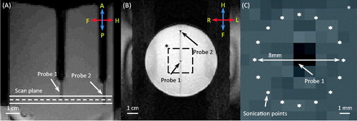 Figure 2. T1-weighted images acquired along (A) and across (B) the ultrasound beam. Two fibre-optic temperature probes were used to validate MR thermometry during MR-HIFU hyperthermia exposures in a phantom. The dashed line in (A) depicts the centre of the plane where MR thermometry was performed during heating. The locations of two temperature probes are shown in (B). Zoomed-in view of the dashed square region in (B) is shown in (C), with the precise location of heating. The ultrasound beam was rapidly scanned along an 8-mm circular trajectory resulting in a uniform region of heating around probe 1.