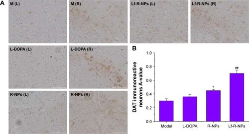 Figure 6 DAT expression by immunostaining in substantia nigra.Notes: (A) Representative images of DAT immunostainng in the substantia nigra of rats; (B) Data were analyzed by counting the relative optical density value (A-value) using Image-Pro Plus 6.0 software. The A-value are expressed as mean ± SD (n=5). *P<0.05 compared with L-DOPA group. ##P<0.01 compared with R-NPs group. Scale bar = 1,000 μm.Abbreviations: DAT, dopamine transporter; L-DOPA, levodopa; R-NPs, rotigotine nanoparticles; M, model; L, left; R, right.