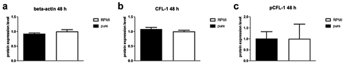 Figure 6. Protein levels of ß-actin (A), CFL-1 (B) and inactive pCFL-1(C) after long-term SGBS adipocyte-conditioned medium stimulation. NK-92 cells were incubated for 48 hours with RPMI supplemented with 250 µl pure SGBS adipocyte-conditioned medium (harvested on day 10 of adipogenesis). NK-92 cells incubated with RPMI only served as controls. All data represent means ± SEM. Data was pooled from three independent replicates.