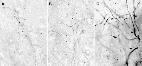 Figure 3 High power photomicrographs of axons within the LGN.