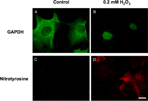 Figure 2. In vitro human RPE GAPDH and nitrotyrosine. Cultured human RPE cells (second passage) were exposed to control medium (A, C) or medium containing 200 µM hydrogen peroxide (B, D) for 24 hours. Immunocytochemistry for GAPDH (A, B) and nitrotyrosine (C, D) was performed. Bar = 10 µm.