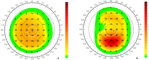 Figure 2 Ablation map of right (a) and left (b) eye.