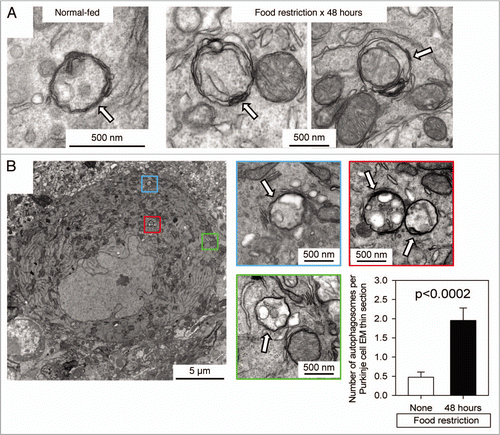 Figure 4 TEM identification and quantitation of autophagosomes in Purkinje cells of normal-fed and food-restricted mice. (A) Images from Purkinje cells of normal-fed (left) or 48 hour food-restricted (middle & right) mice are shown. (B) A single Purkinje cell from a 48 hour food-restricted mouse is shown. Autophagosomes are enclosed in colored boxes, and higher-magnification images of each are provided, with autophagosomes indicated by white arrows. For both normal-fed and food-restricted mice, autophagosomes were enumerated in TEM sections of ∼20 different Purkinje cells; sections from food-restricted mice showed a ∼4-fold increase in autophagosome number (graph, bottom right; p < 0.0002 by Student's t test).