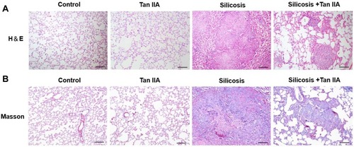 Figure 3 Tanshinone IIA attenuates silica-induced pulmonary fibrosis. Animals and treatments are as described under Materials and Methods. (A) Representative H&E staining of sections of lung tissues (magnification, 100×). (B) Representative Masson staining of lung tissues (magnification, 100×). Scale bar=100 μm.