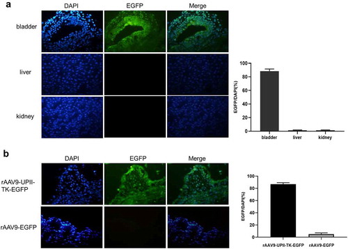 Figure 2. Analysis of the in vivo targeting and efficacy of rAAV9-UPII-TK-EGFP. (a) Intravesical instillation of rAAV9-UPII-TK-EGFP can infect mouse bladder cells without infecting kidney and liver cells. (b) Variable intensity of green fluorescence is detected in frozen sections of the bladder. rAAV9-UPII-TK-EGFP can efficiently infect mouse bladder cells
